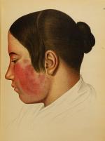 Goldschmid, Entwicklung und Bibliographie der Pathologisch-Anatomischen Abbildung.
