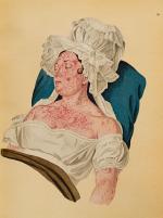 Goldschmid, Entwicklung und Bibliographie der Pathologisch-Anatomischen Abbildung.