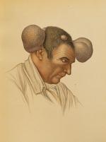 Goldschmid, Entwicklung und Bibliographie der Pathologisch-Anatomischen Abbildung.