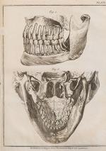 John Hunter - Historia naturalis dentium humanorum - Natuurlyke historie der tan